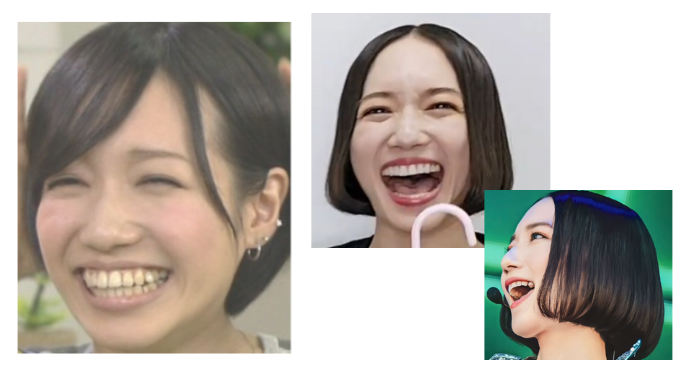 Perfumeのっちの顔が変わった？昔と今で特に違うポイントを比較